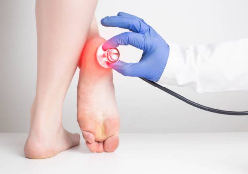 דורבן בעקב טיפול